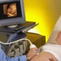 Допплерография во время беременности