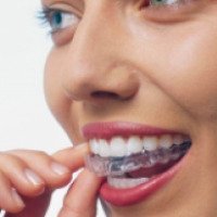 Каппы для выравнивания зубов