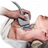 Ультразвуковое исследование щитовидной железы