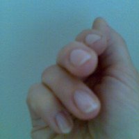 Лак-терапия "Ноготок" для восстановления ногтевой пластины