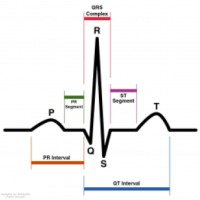 Электрокардиограмма сердца (ЭКГ)