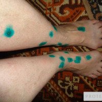 Биопсия кожи с гистологическим исследованием